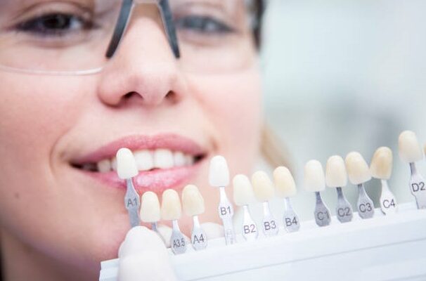 Dental Implants