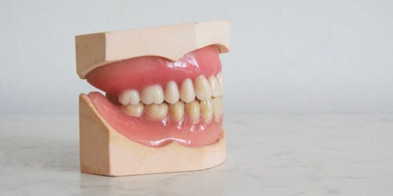 Temporary Dentures