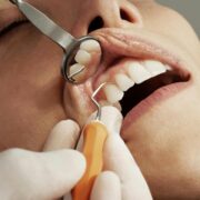 periodontal cleanings