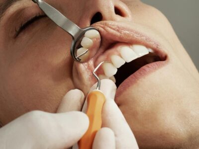 periodontal cleanings