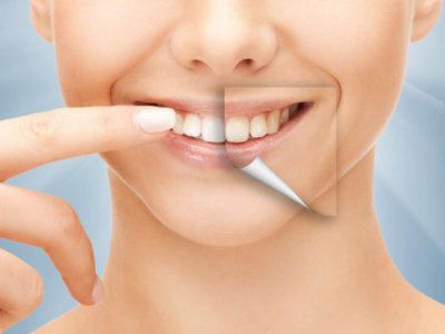 Cosmetic Dentistry