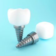 Front Dental Implant